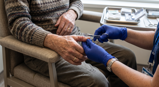 A close up on an old man getting stitches removed from his thumb.