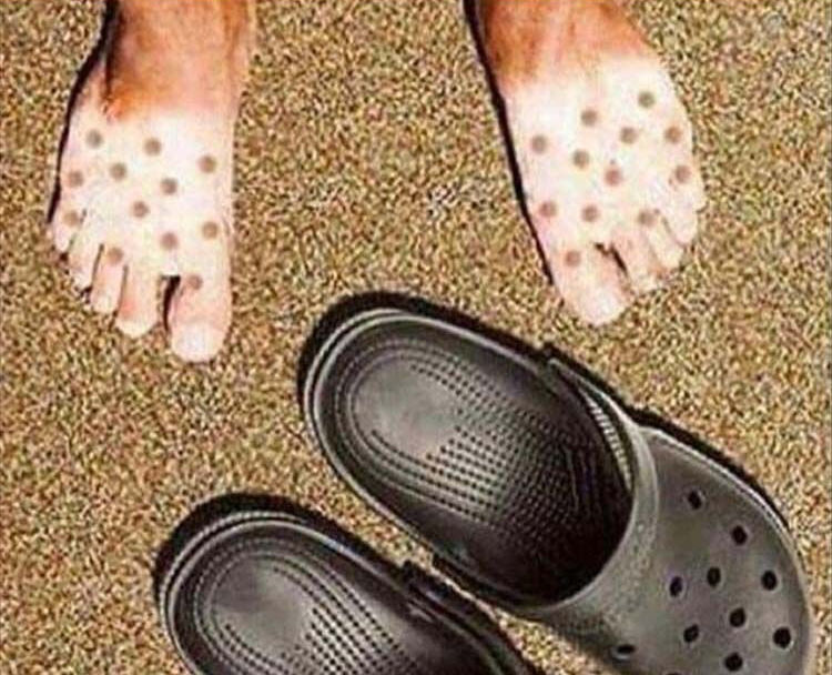 A funny picture of feet that have tanned while wearing crocs.